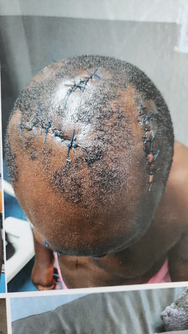 Fear Grips Mbeya Island as Residents Protest Release of Crime Suspect 1 IMG 20260225 WA0292