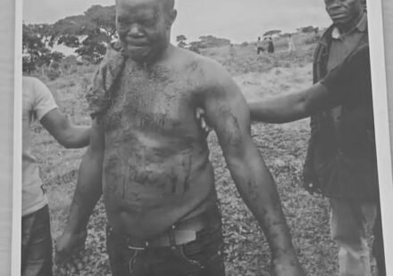 Namara stained with blood after he was rescued
