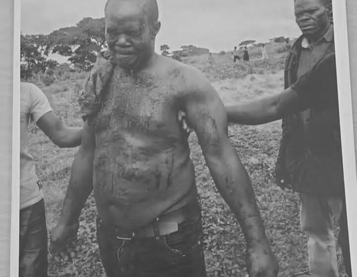 Namara stained with blood after he was rescued
