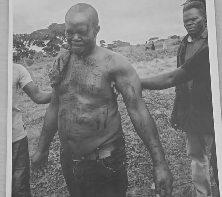 Namara stained with blood after he was rescued